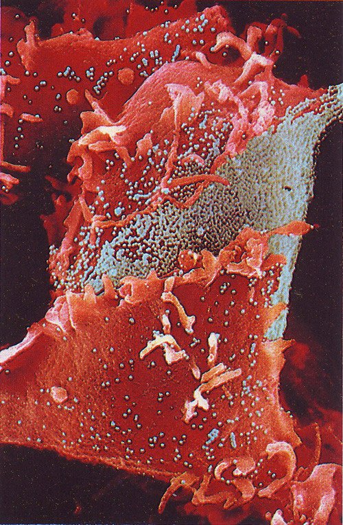 16-Наша невероятная иммунная система - микрофотографии