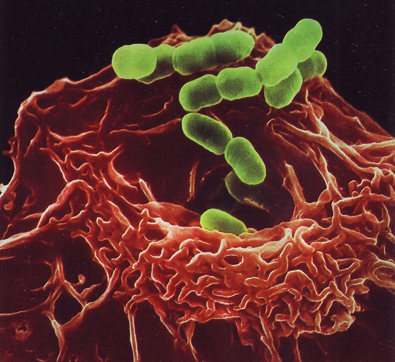 08-Наша невероятная иммунная система - микрофотографии