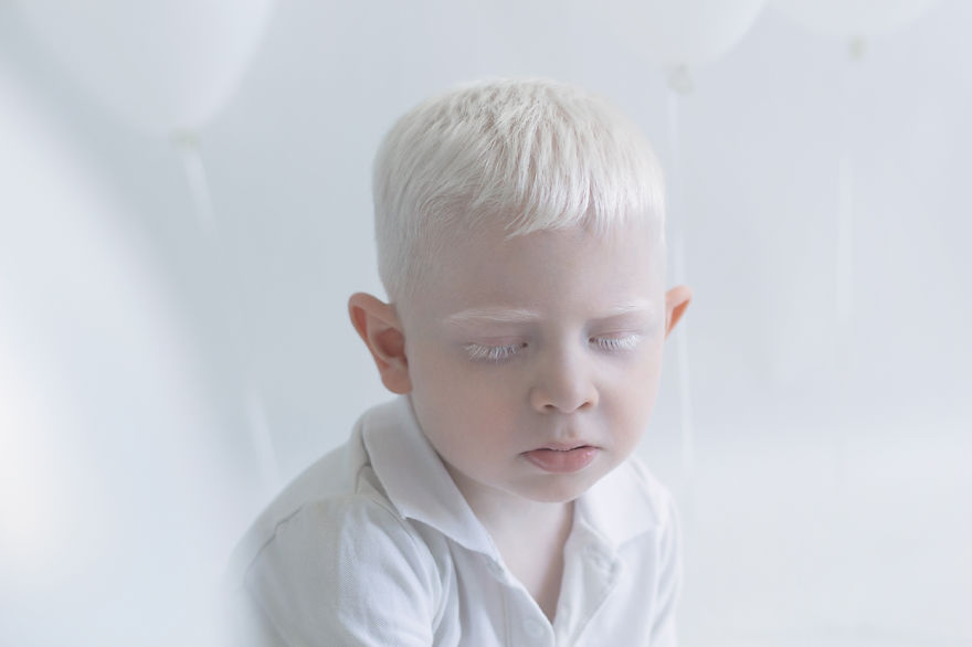 «Фарфоровая красота»: фотопроект о неземной привлекательности людей-альбиносов 18