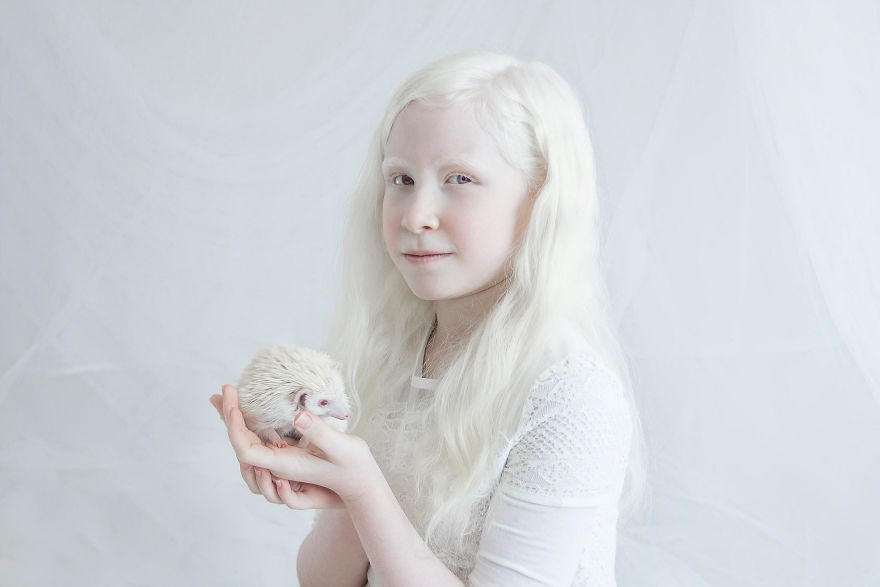 «Фарфоровая красота»: фотопроект о неземной привлекательности людей-альбиносов 2