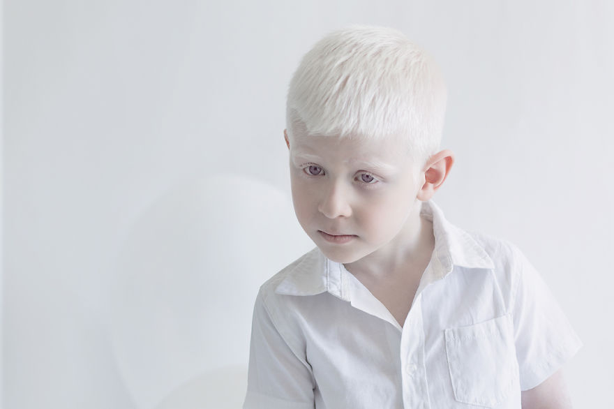 «Фарфоровая красота»: фотопроект о неземной привлекательности людей-альбиносов 22