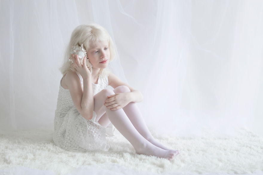 «Фарфоровая красота»: фотопроект о неземной привлекательности людей-альбиносов 23