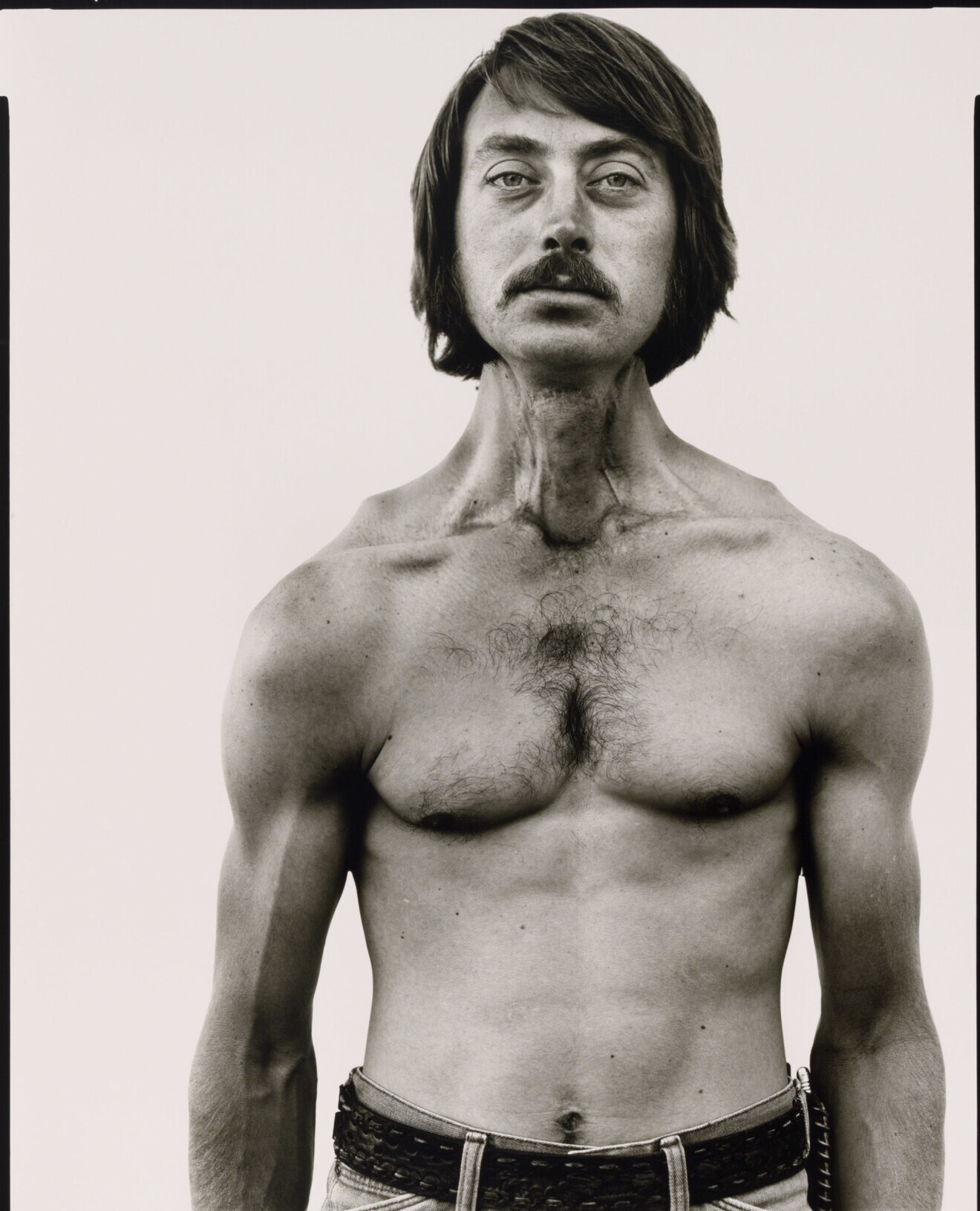 Дэйв Тимоти, пострадавший от радиоактивных осадков, Орем, Юта, 1980. Фотограф Ричард Аведон