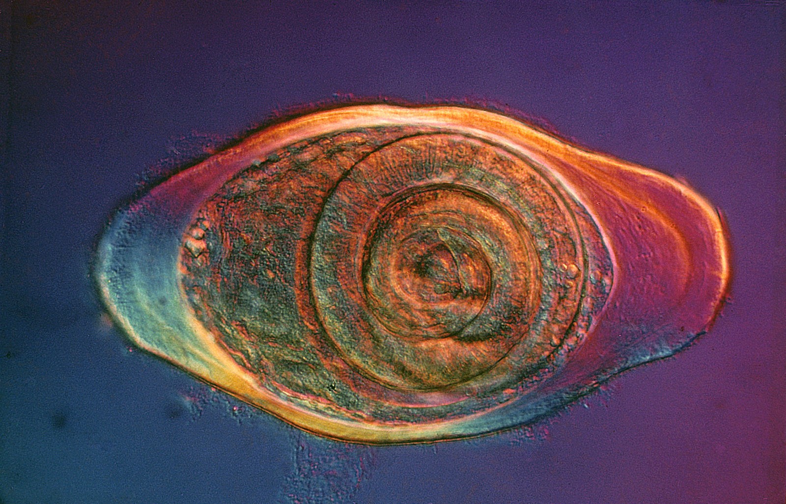 Микрофотография энцистированного паразитического круглого червя, 1976. Фотограф Эрик В. Граве