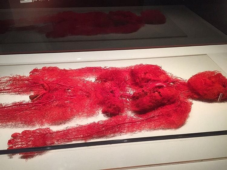 Кровеносные сосуды человека, завещавшего своё тело на нужды науки. Экспонат с выставки Мир тела