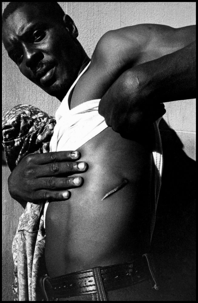 Торговец наркотиками с 14-й улицы показывает одно из своих многочисленных ножевых ранений, Нью-Йорк, 1978. Фотограф Леонард Фрид