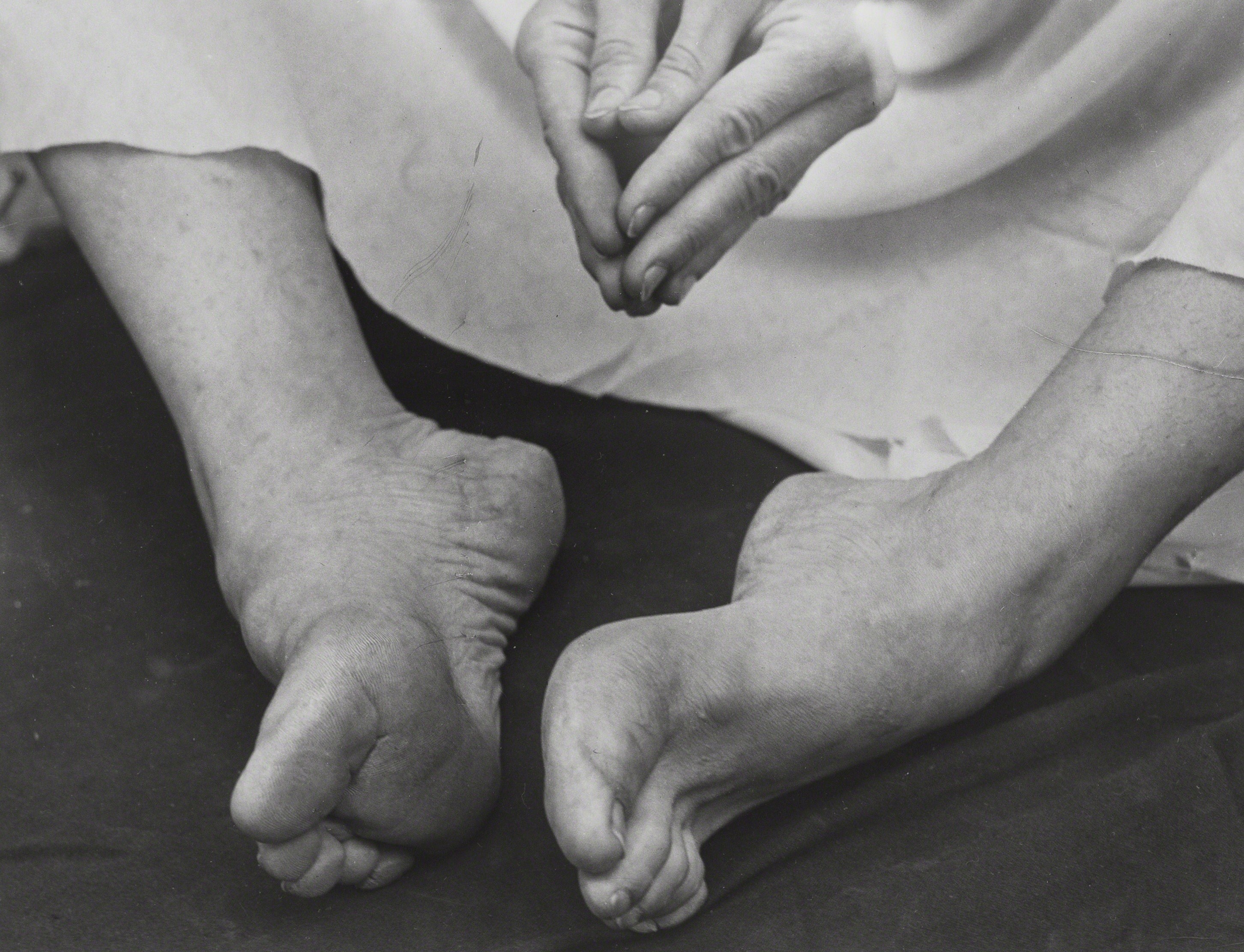 Ноги Марты Грэм, 1931. Фотограф Имоджен Каннингем
