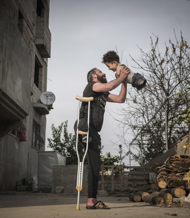 «Фото года» 2021. Трудности жизни. Мальчик, родившийся без конечностей, с отцом, который потерял ногу во время взрыва в Сирии. Автор Мехмет Аслан