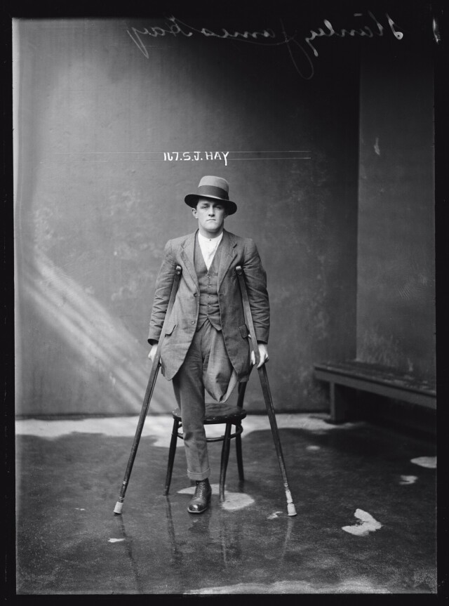 Стэнли Джеймс Хэй, подозреваемый в краже, нога ампутирована из-за ранения в бою. После Первой мировой многие солдаты, чтобы свести концы с концами, обращались к преступлениям. Архив судебной фотографии полиции Нового Южного Уэльса