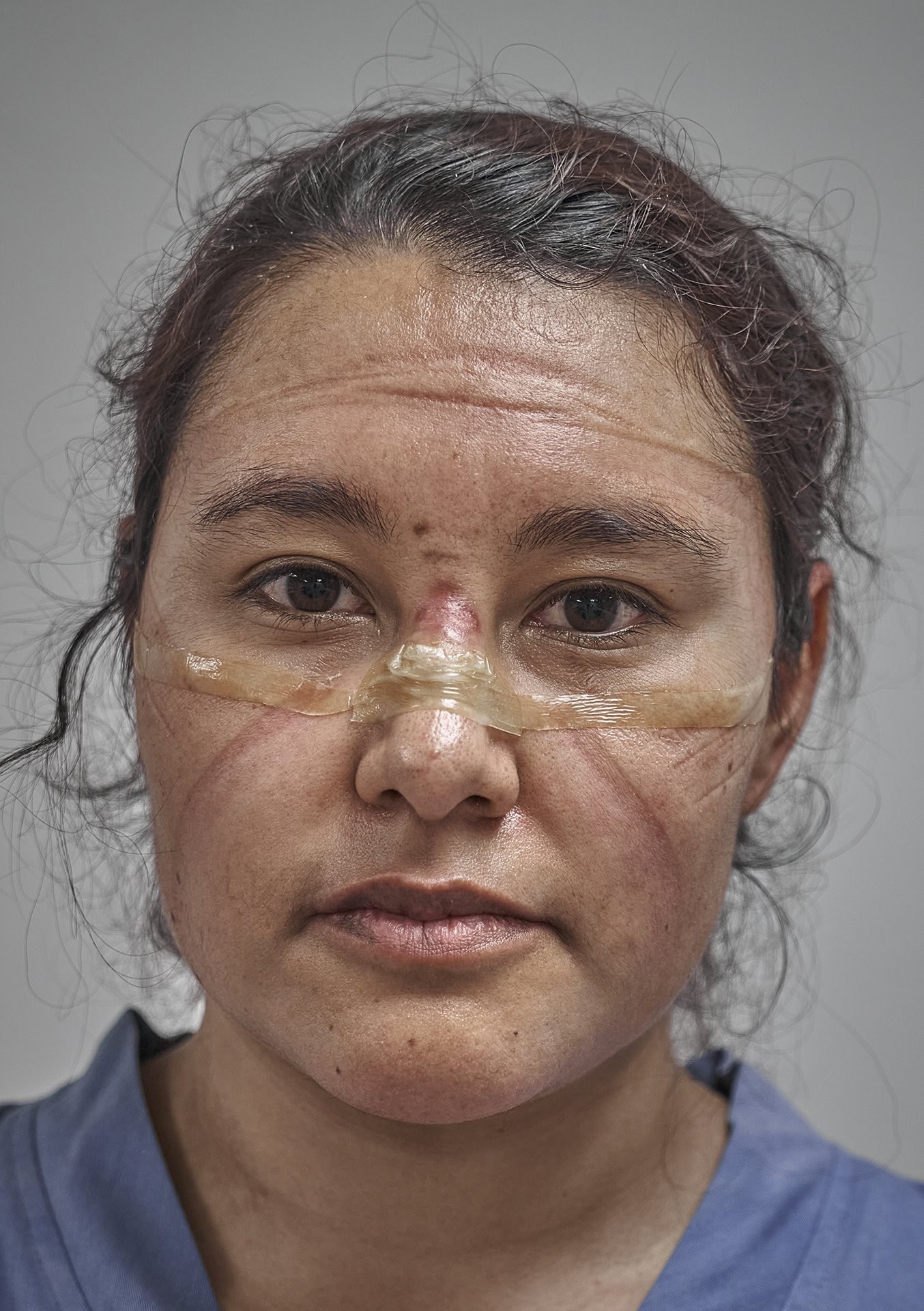 2 место в категории Портреты, 2021. Доктор в конце смены со следами от защитной маски, Мехико, Мексика, 19 мая 2020 года. Автор Иван Масиас