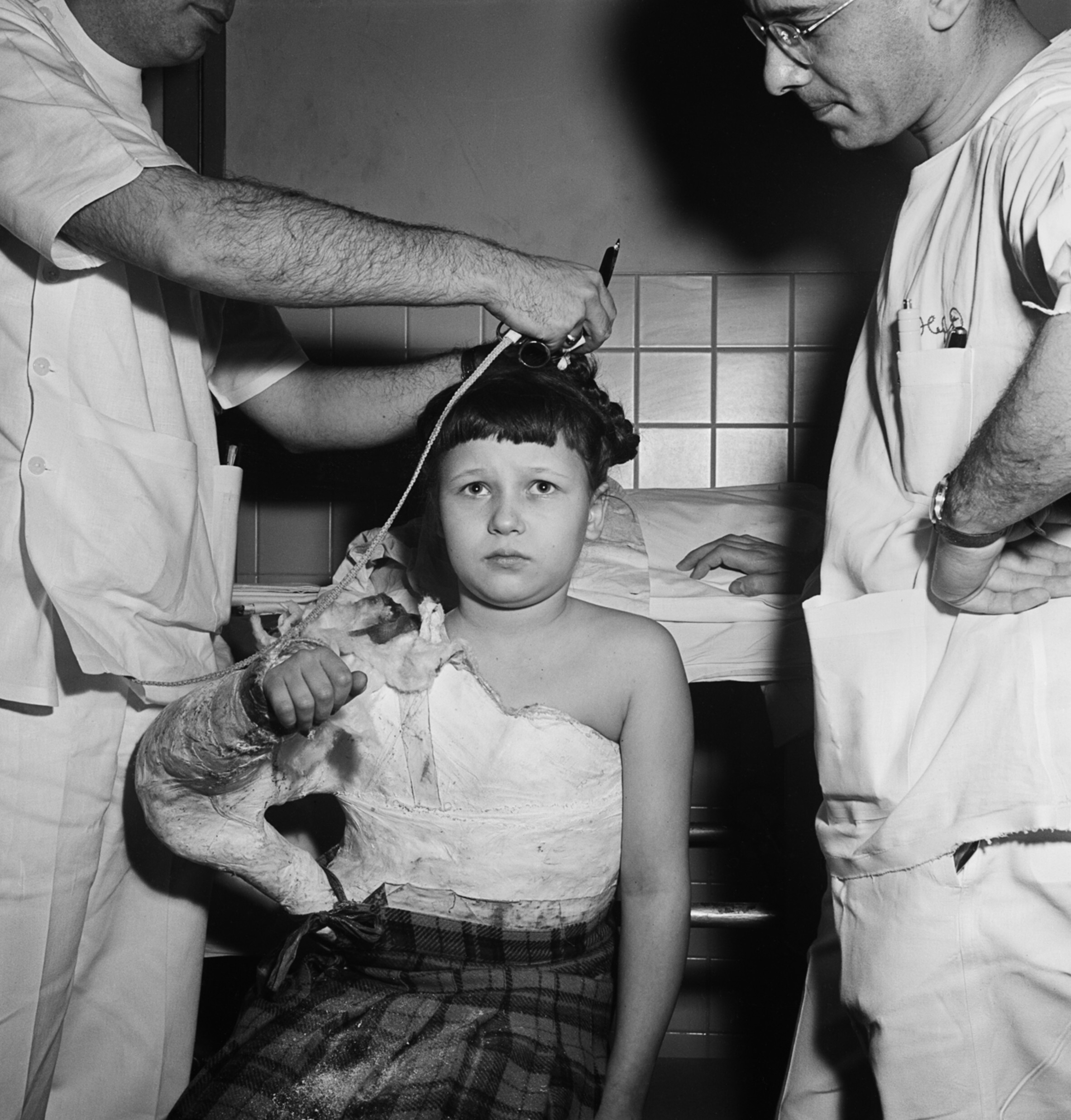 Врачи снимают гипс с тела молодого пациента, Еврейская больница суставных заболеваний, Восточный Гарлем, Нью-Йорк, конец 1940-х - начало 1950-х гг. Фотограф Роман Вишняк