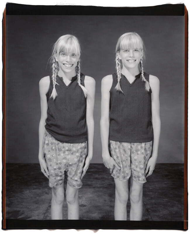 Минди и Мишель Нельсон, 11 лет, Мишель старше на 1 минуту, Твинсбург, Огайо, 2001 г. Фотопроект Близнецы. Фотограф  Мэри Эллен Марк