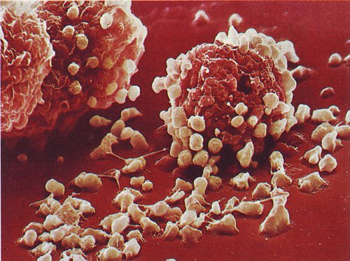 14-Наша невероятная иммунная система - микрофотографии