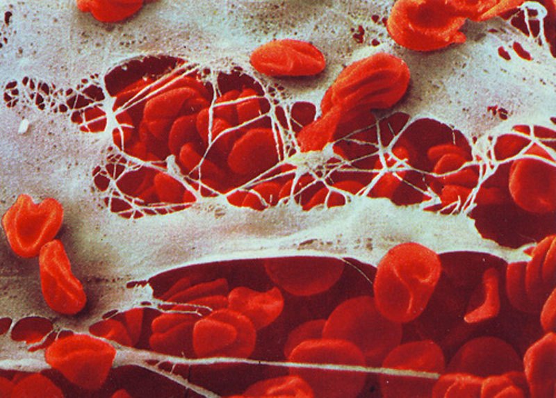 05-Наша невероятная иммунная система - микрофотографии