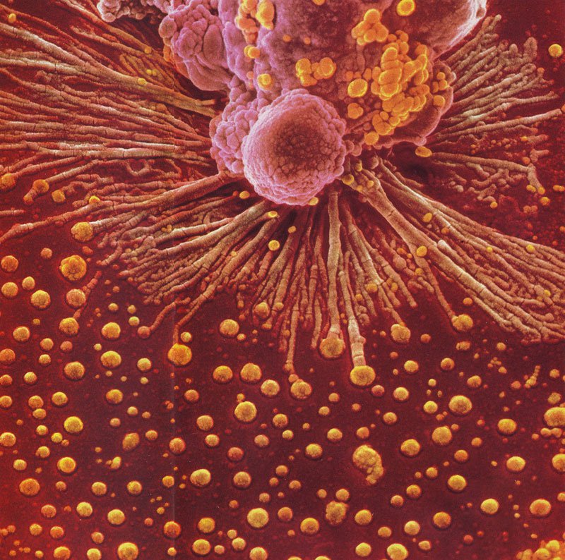 01---Наша невероятная иммунная система - микрофотографии