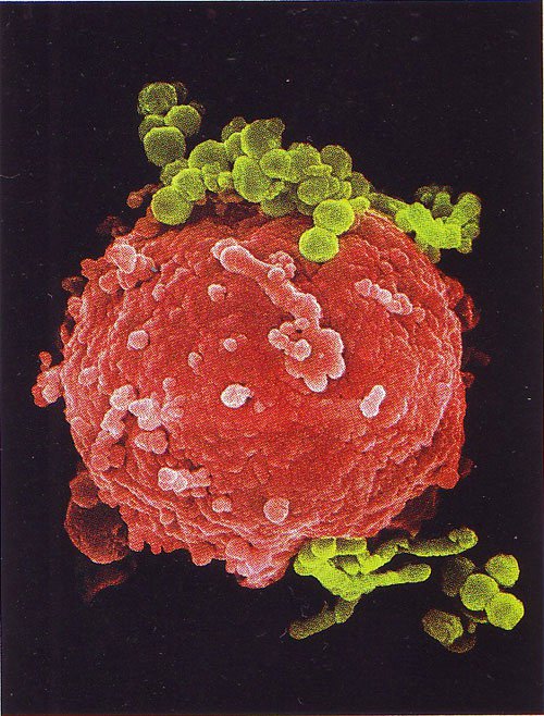 03-Наша невероятная иммунная система - микрофотографии