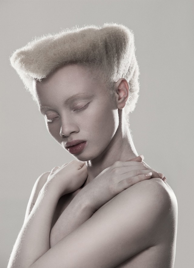 Южноафриканский фотограф разрушает суеверия, чтобы помочь альбиносам