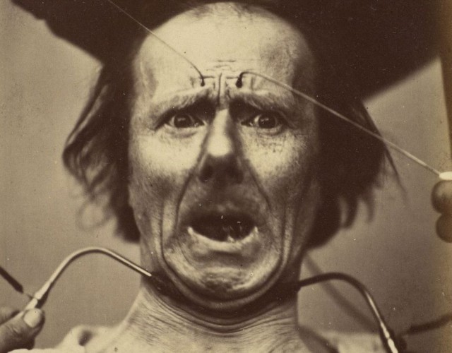 Наука, ты меня пугаешь: как невропатолог Дюшен де Булонь изучал эмоции и мышцы лица в 1862 году