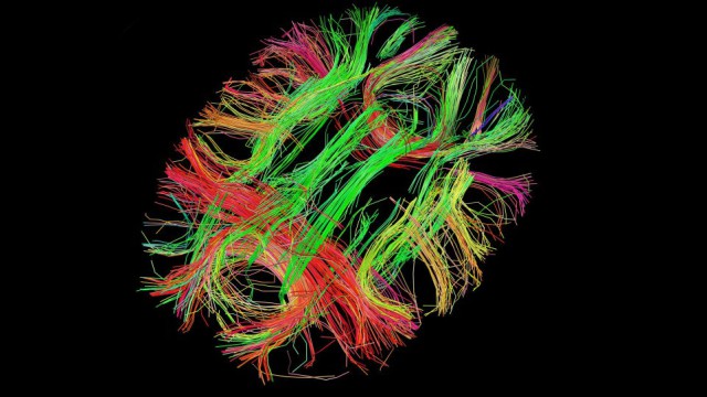 Сознание человека может быть результатом хаоса в работе нейронных сетей