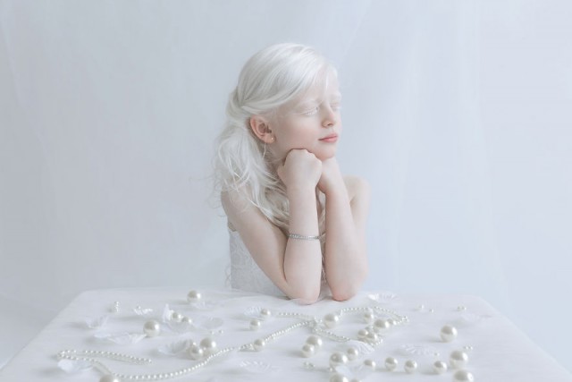«Фарфоровая красота»: фотопроект о неземном очаровании людей-альбиносов