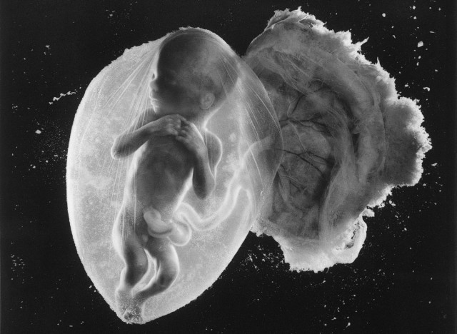 «Эмбрион, 18 недель»: возможно, величайшая фотография 20-го века