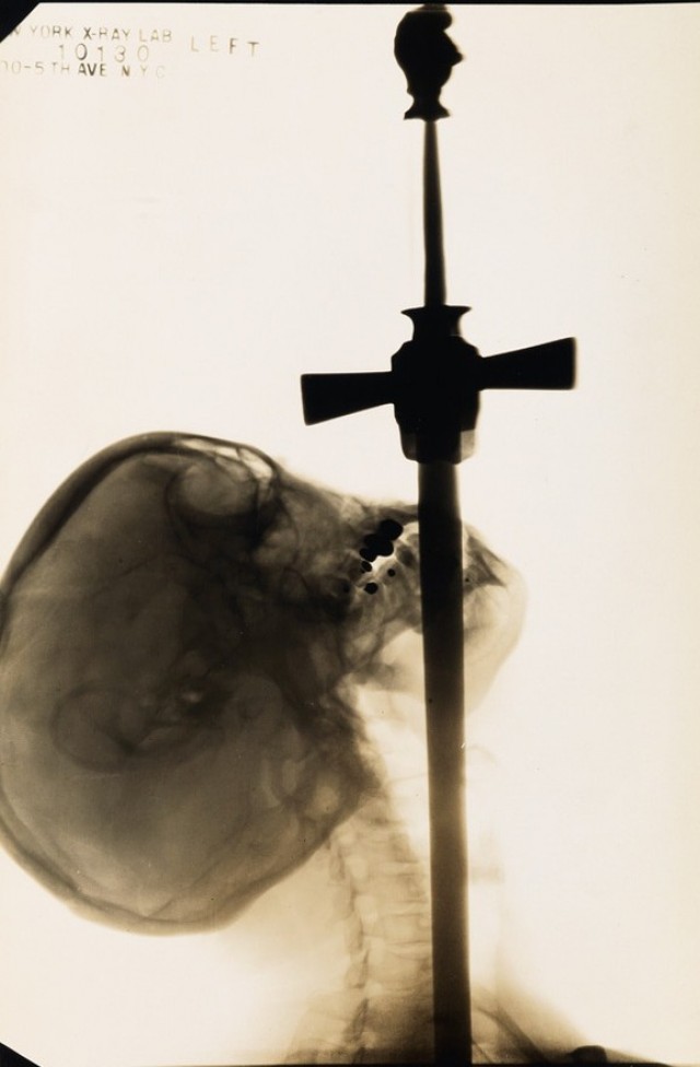 Рентгеновский снимок шпагоглотателя и другие редкие цирковые фотографии Эдварда Келти