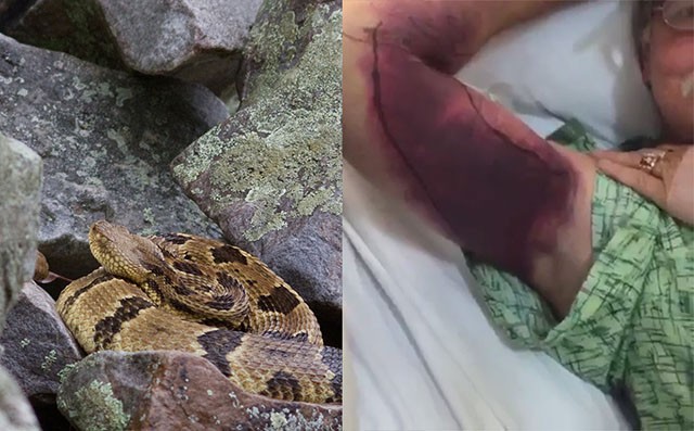Мужчина хотел сделать селфи с гремучей змеёй и поплатился здоровьем на сумму 153 000 долларов