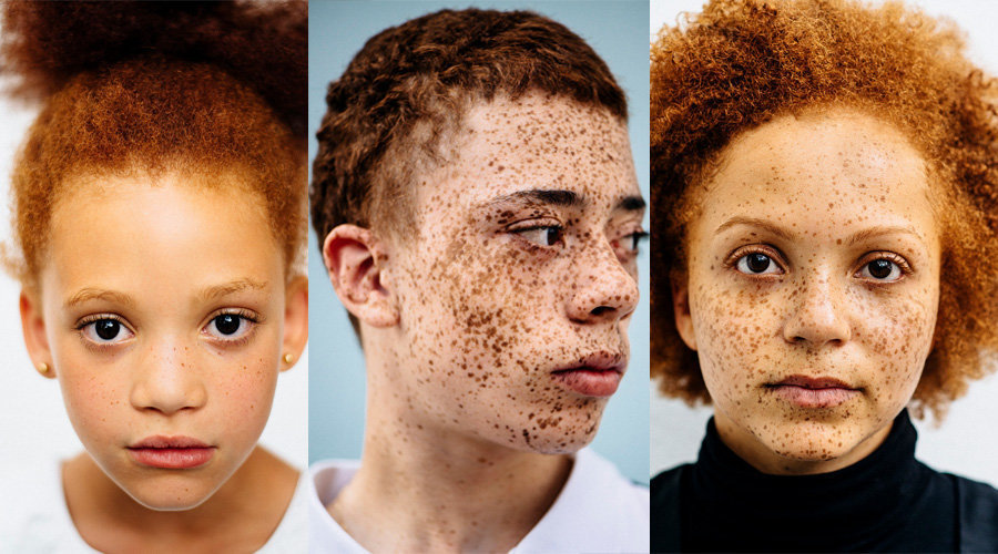 Фотограф Мишель Маршалл сделала портреты рыжеволосых людей с веснушками, чтобы разрушить стереотипы