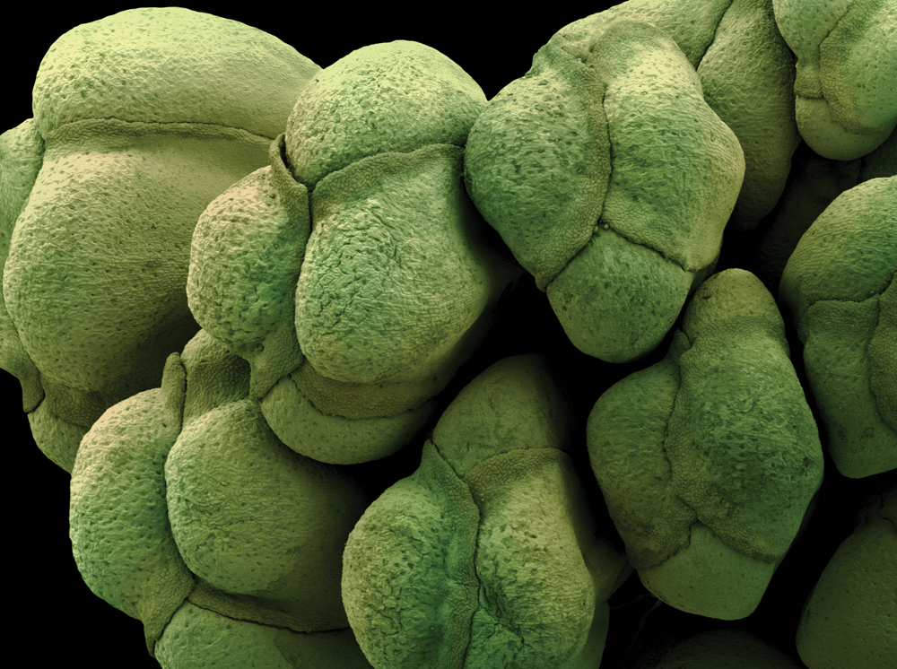Фрукты и овощи под микроскопом - микрофотографии - 2