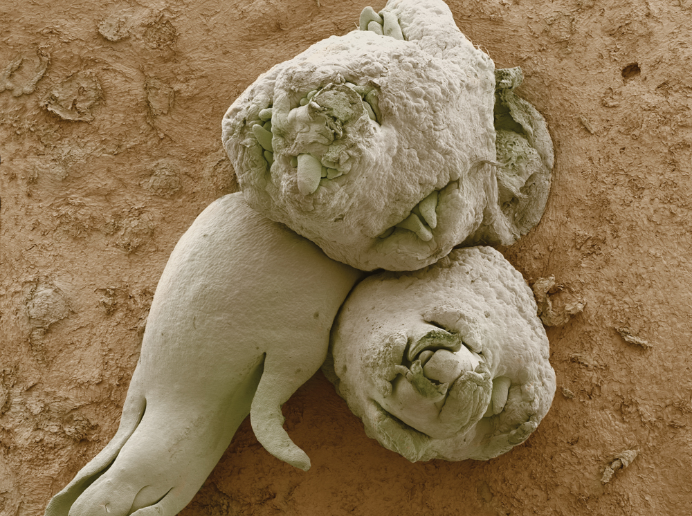 Фрукты и овощи под микроскопом - микрофотографии - 6