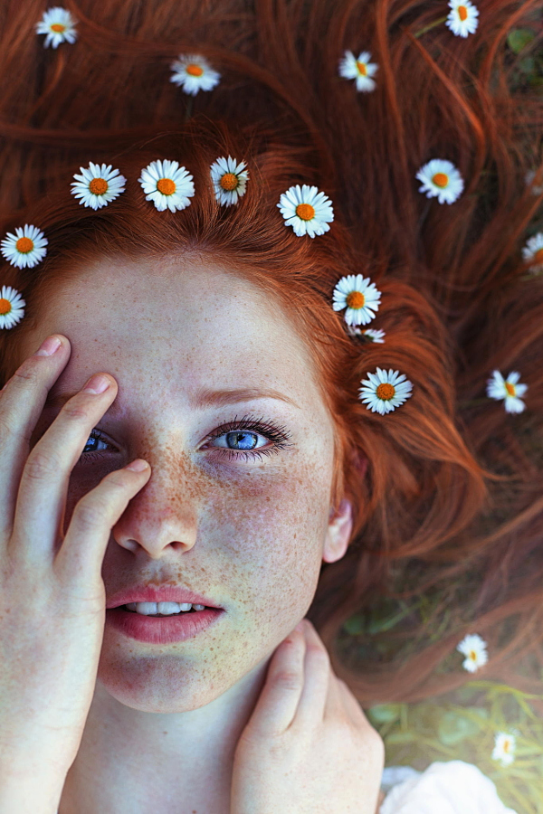 30 портретов, которые вызывают любовь к веснушкам
