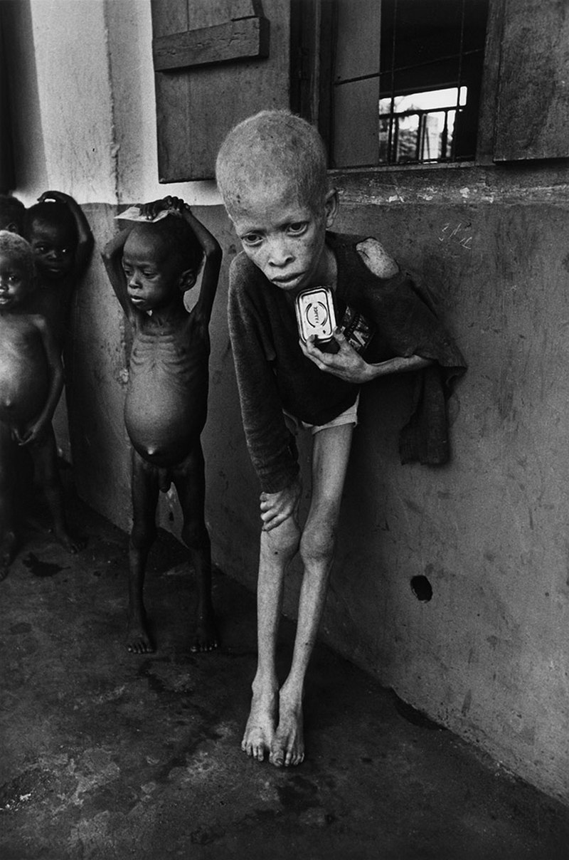 Albino Boy Biafra Don McCullin 1969
