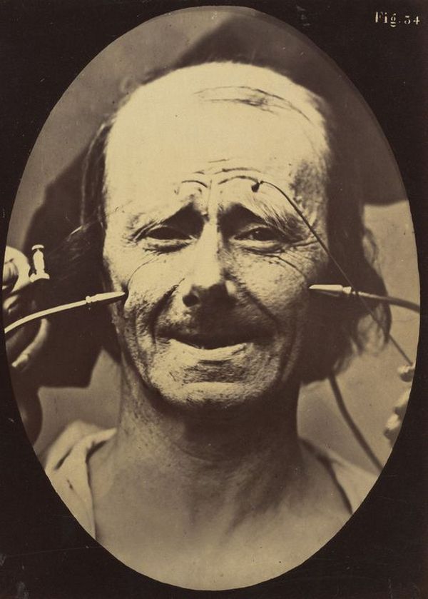 Зрелищные фотографии из книги невропатолога Дюшена де Булоня   16