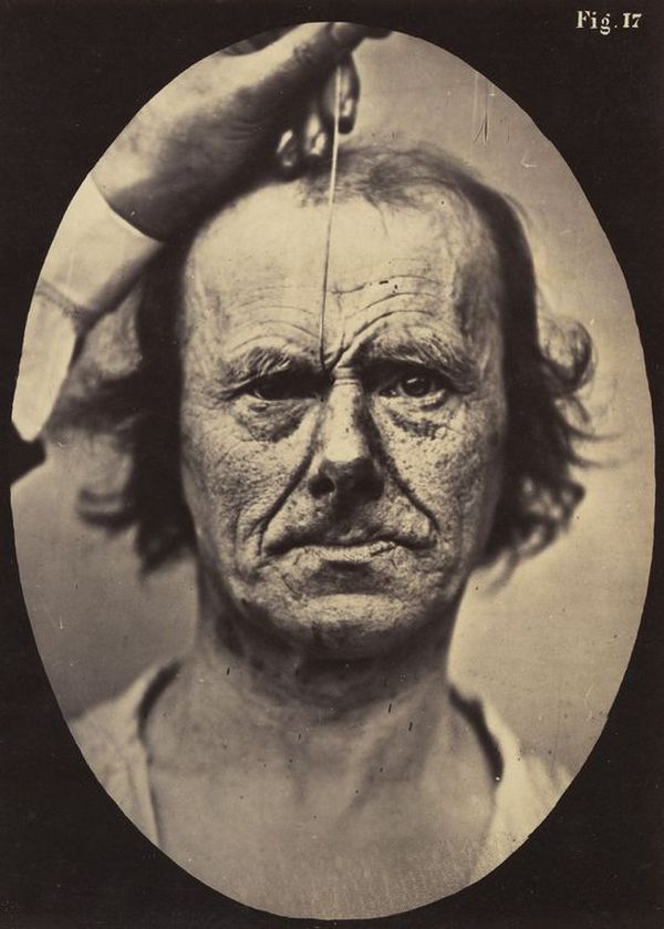 Зрелищные фотографии из книги невропатолога Дюшена де Булоня   31