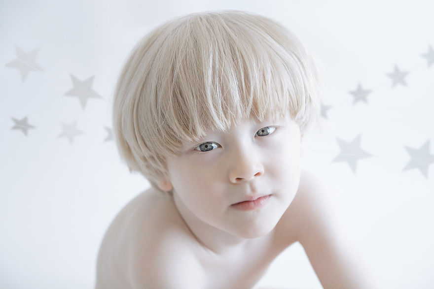 «Фарфоровая красота»: фотопроект о неземной привлекательности людей-альбиносов 11