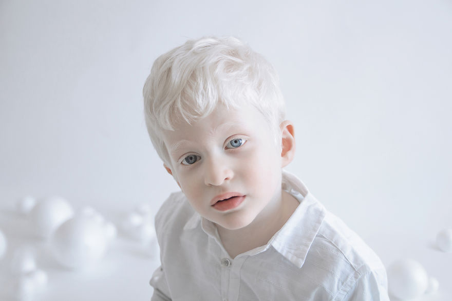 «Фарфоровая красота»: фотопроект о неземной привлекательности людей-альбиносов 12