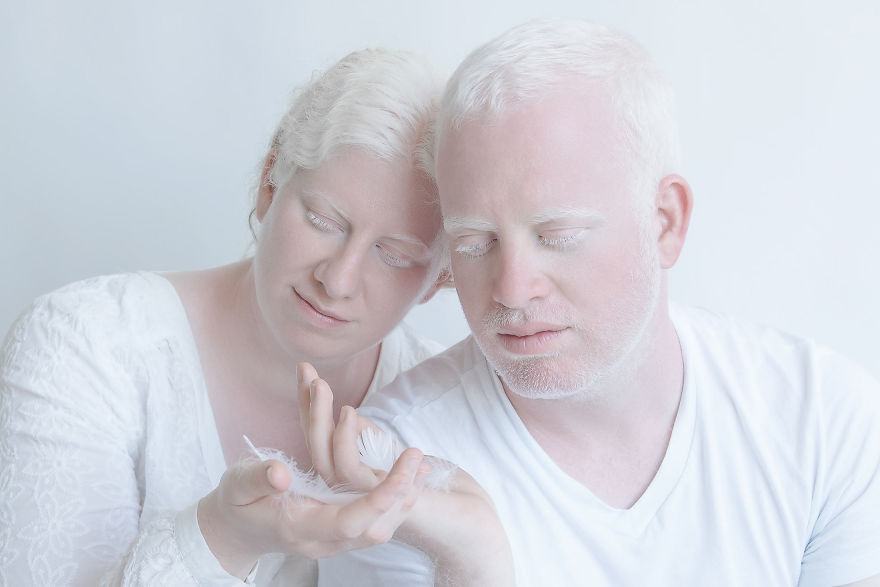 «Фарфоровая красота»: фотопроект о неземной привлекательности людей-альбиносов 13
