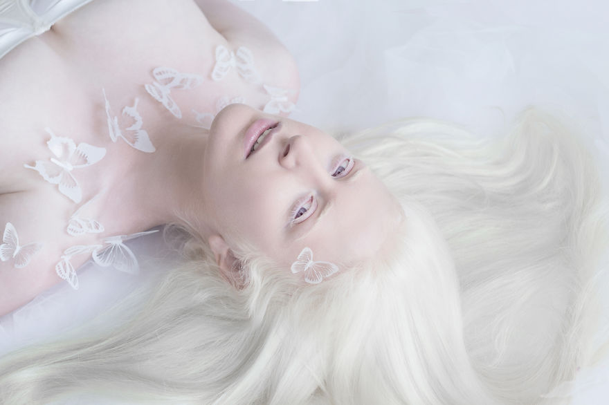 «Фарфоровая красота»: фотопроект о неземной привлекательности людей-альбиносов 14