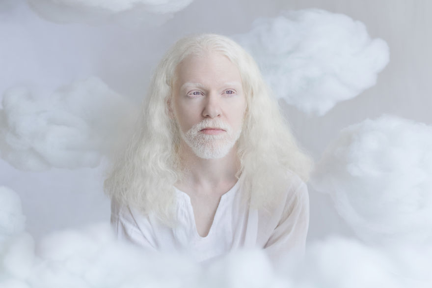 «Фарфоровая красота»: фотопроект о неземной привлекательности людей-альбиносов 16