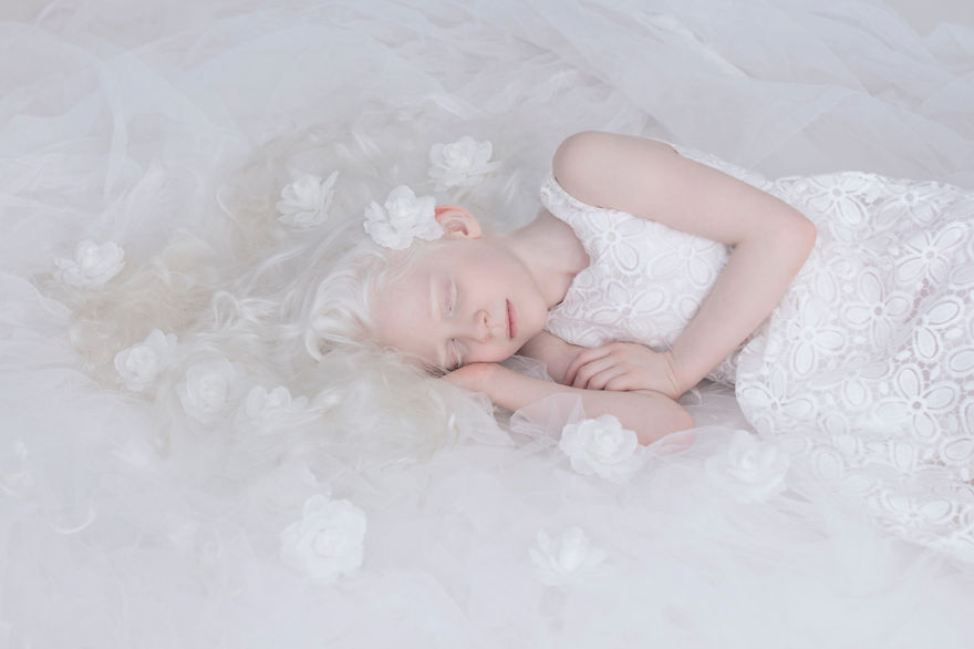 «Фарфоровая красота»: фотопроект о неземной привлекательности людей-альбиносов 17