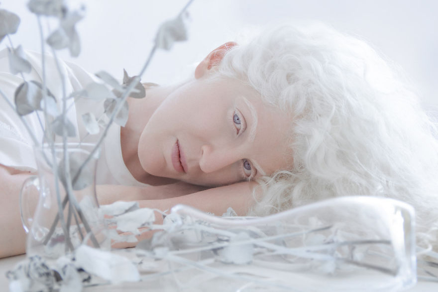 «Фарфоровая красота»: фотопроект о неземной привлекательности людей-альбиносов 3