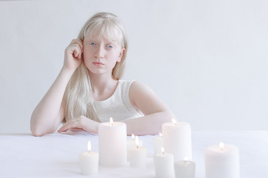 «Фарфоровая красота»: фотопроект о неземной привлекательности людей-альбиносов 5