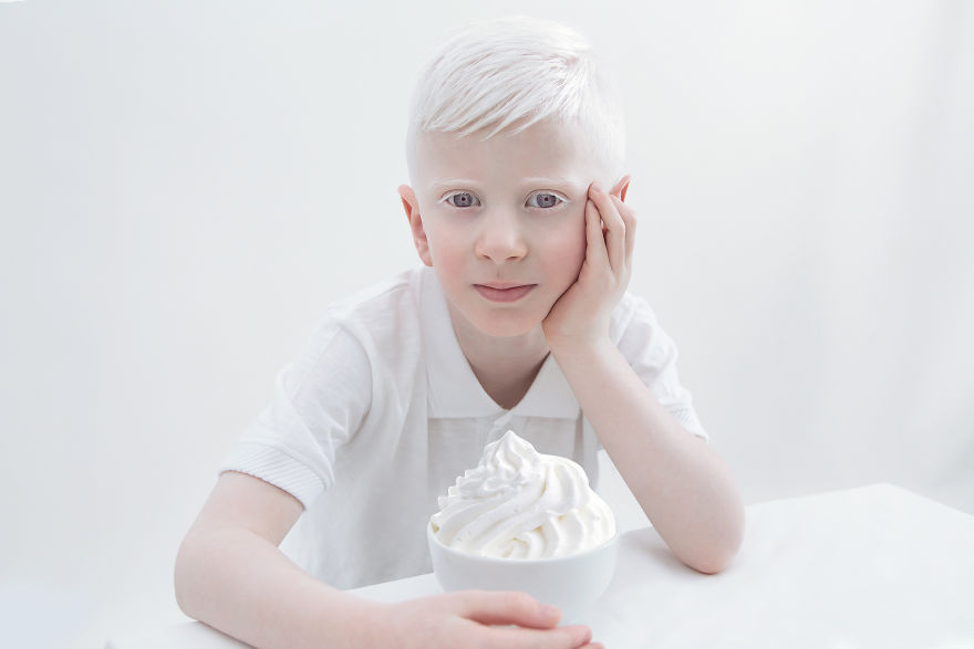 «Фарфоровая красота»: фотопроект о неземной привлекательности людей-альбиносов 6