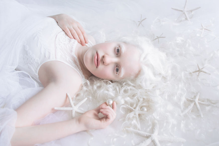«Фарфоровая красота»: фотопроект о неземной привлекательности людей-альбиносов 7