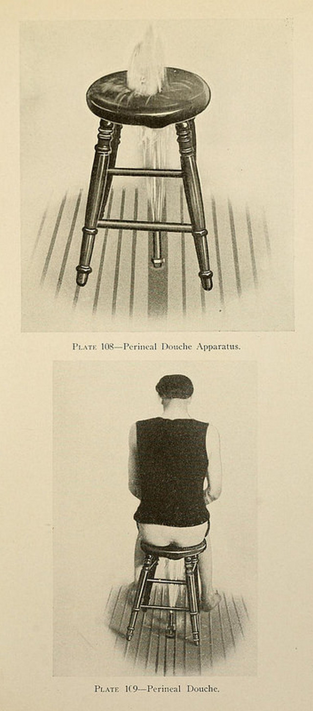 Душ, пар и клизма от паранойи и алкоголизма: иллюстрации из «Практической гидротерапии» 1909 года 21