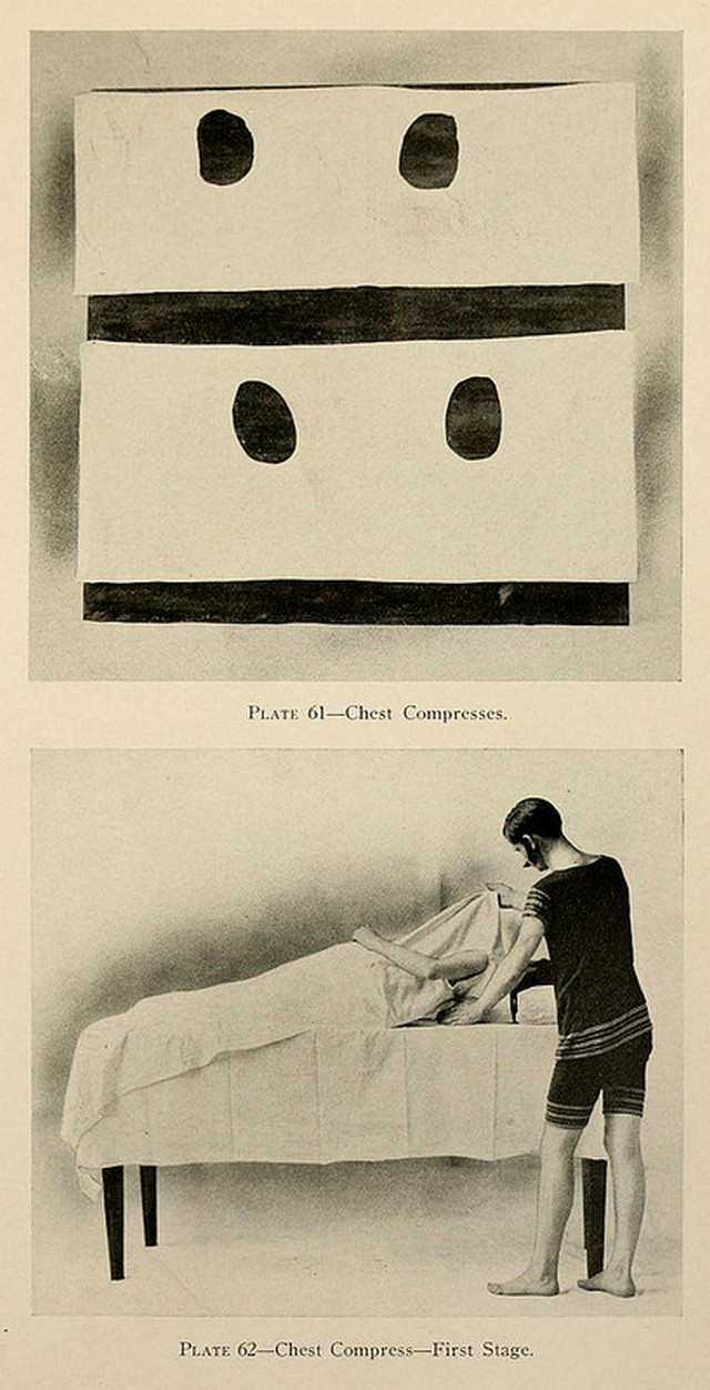Душ, пар и клизма от паранойи и алкоголизма: иллюстрации из «Практической гидротерапии» 1909 года 27