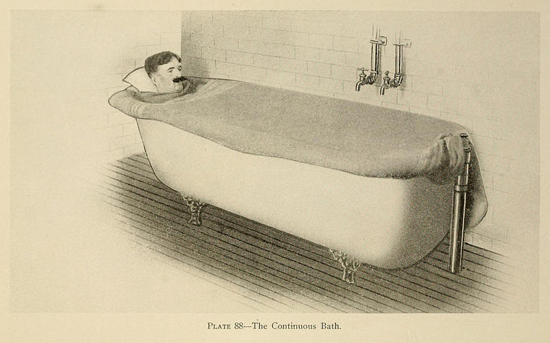 Душ, пар и клизма от паранойи и алкоголизма: иллюстрации из «Практической гидротерапии» 1909 года 8