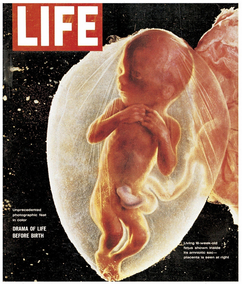 «Эмбрион, 18 недель»: возможно, величайшая фотография 20-го века 4